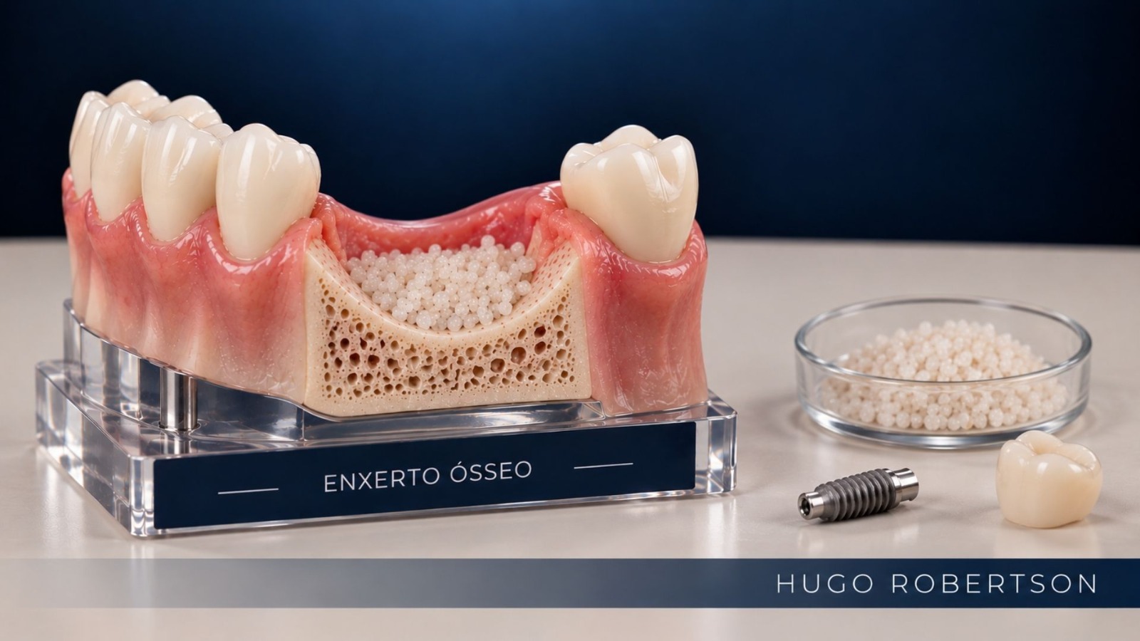 dr hugo enxerto osseo