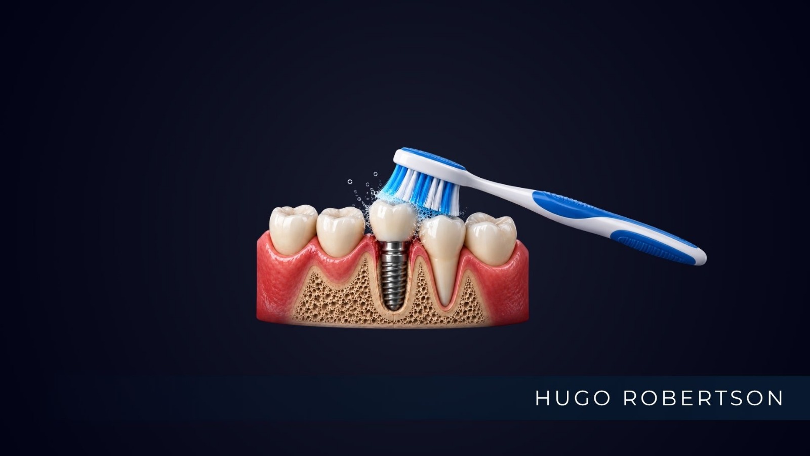 dr hugo robertson escova de dente e implante